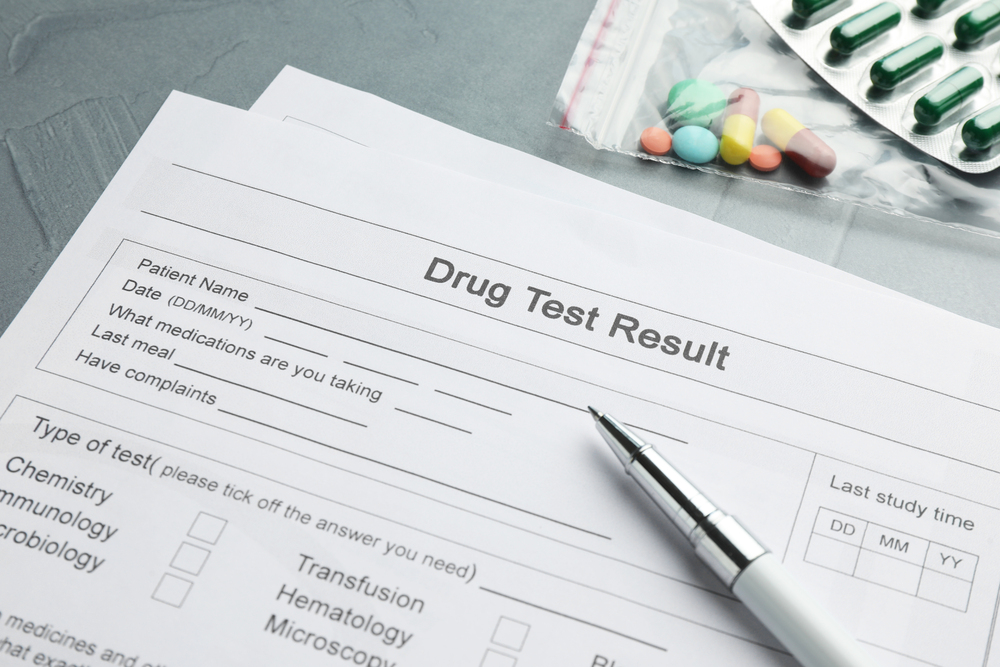 Does Suboxone Show Up On A Drug Test?